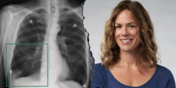 How Nvidia’s AI robots are reshaping modern medicine