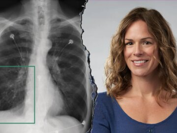 How Nvidia’s AI robots are reshaping modern medicine